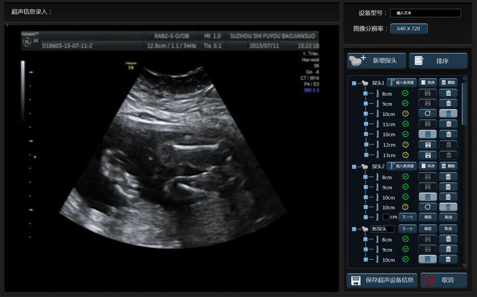 武漢睿影醫(yī)療科技超聲系統(tǒng)軟件界面設(shè)計(jì)